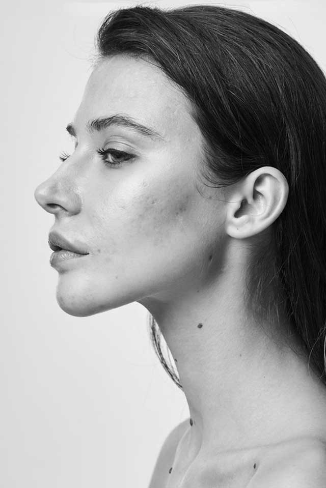 Skinvive